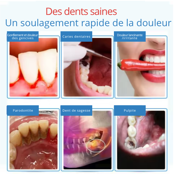 Spray Dentaire-Antidouleur Dentaire